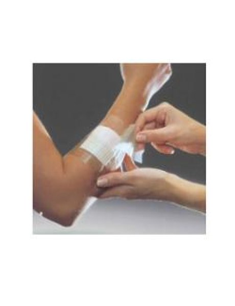 OPSITE FLEXIFIX 10X1000 1MED